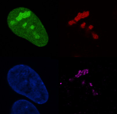 nucleolus-IF